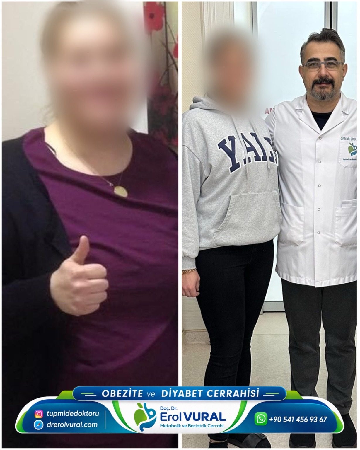 Before / after · Patient experience