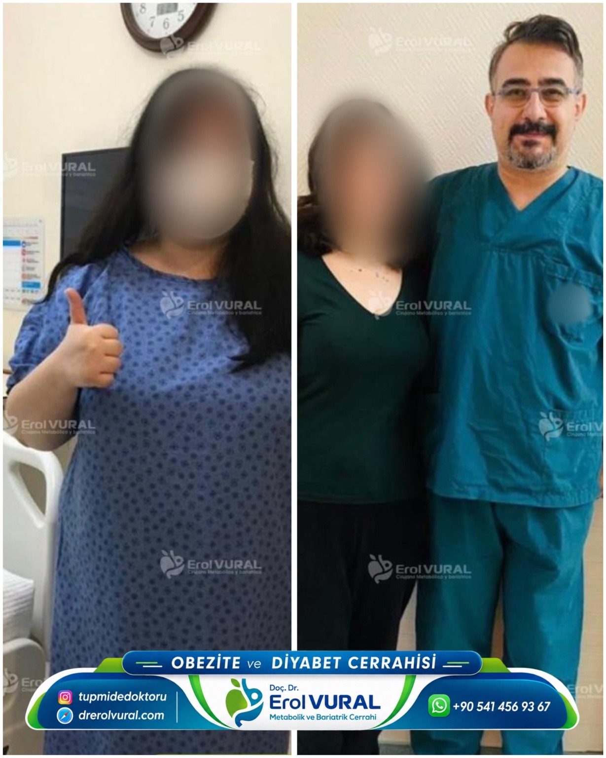 Before / after · Patient experience
